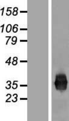 Western Blot: JAM-A Overexpression Lysate [NBP2-11275]