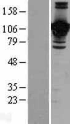 Western Blot: JAM-B/VE-JAM Overexpression Lysate [NBP2-04384]