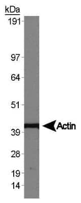 Western Blot: Jurkat Whole Cell Lysate [NB800-PC2]