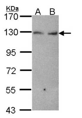 Western Blot: Cadherin-6/KCAD Antibody [NBP2-17012]