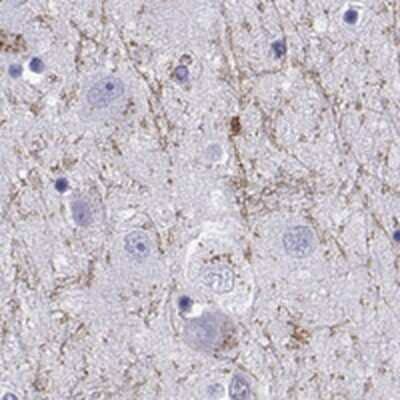 Immunohistochemistry-Paraffin: KA1/GRIK4/Glutamate Receptor KA1 Antibody [NBP2-62686]