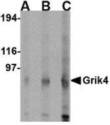 Western Blot: KA1/GRIK4/Glutamate Receptor KA1 AntibodyBSA Free [NBP1-76851]