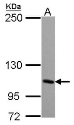 Western Blot: KA1/GRIK4/Glutamate Receptor KA1 Antibody [NBP2-16683]