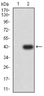 Western Blot: KA2/GRIK5/Glutamate Receptor KA2 Antibody (4G5H8)BSA Free [NBP2-61804]