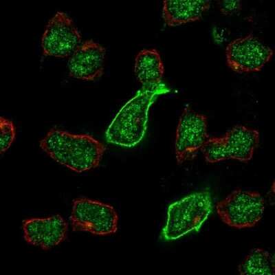 Immunocytochemistry/ Immunofluorescence: KA2/GRIK5/Glutamate Receptor KA2 Antibody [NBP2-68975]