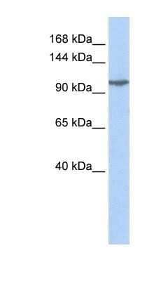 Western Blot: KA2/GRIK5/Glutamate Receptor KA2 Antibody [NBP1-80270]