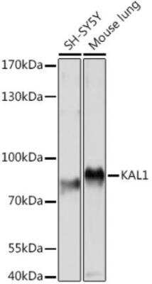 Western Blot: KAL1 AntibodyAzide and BSA Free [NBP3-03937]