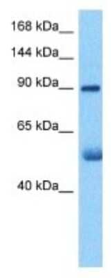 Western Blot: KALRN Antibody [NBP3-10025]