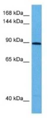 Western Blot: KALRN Antibody [NBP3-10038]