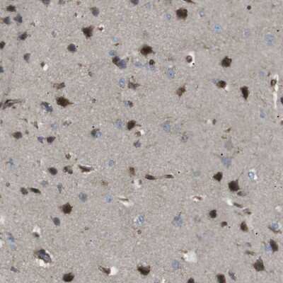 Immunohistochemistry-Paraffin: KANK2 Antibody [NBP1-89080]