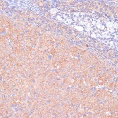 Immunohistochemistry-Paraffin: KANK2 Antibody - Azide and BSA Free [NBP3-04645]