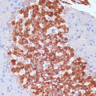 Immunohistochemistry-Paraffin: KANK2 Antibody - Azide and BSA Free [NBP3-04645]