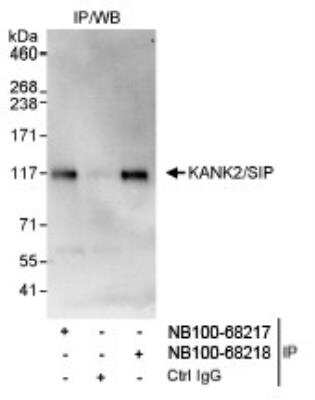 Immunoprecipitation: KANK2 Antibody [NB100-68218]