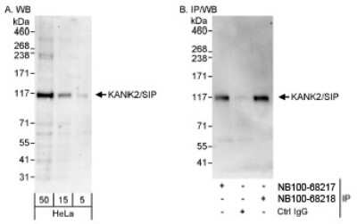 Western Blot: KANK2 Antibody [NB100-68217]