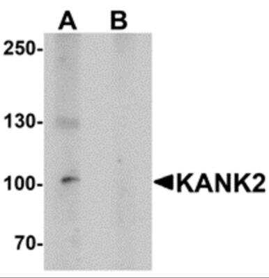 Western Blot: KANK2 AntibodyBSA Free [NBP2-82099]