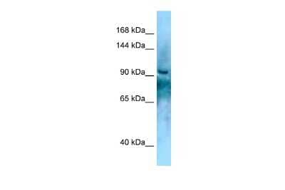 Western Blot: KANK2 Antibody [NBP2-87652]