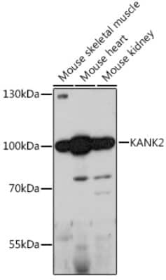 Western Blot: KANK2 AntibodyAzide and BSA Free [NBP3-04645]