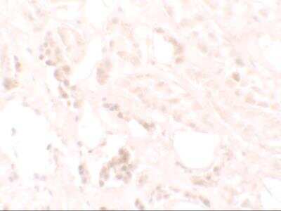 Immunohistochemistry: KANK3 Antibody - BSA Free [NBP2-82100]