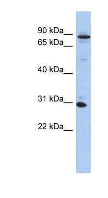 Western Blot: KANK3 Antibody [NBP1-56366]