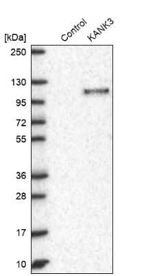 Western Blot: KANK3 Antibody [NBP2-14138]