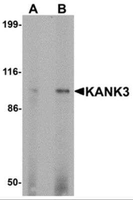 Western Blot: KANK3 AntibodyBSA Free [NBP2-82100]