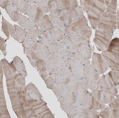 Immunohistochemistry-Paraffin: KANK4 Antibody [NBP1-89079]