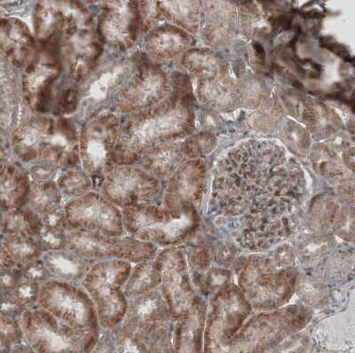 Immunohistochemistry-Paraffin: KANK4 Antibody [NBP1-89079]