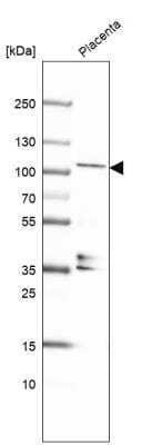 Western Blot: KANK4 Antibody [NBP1-89079]