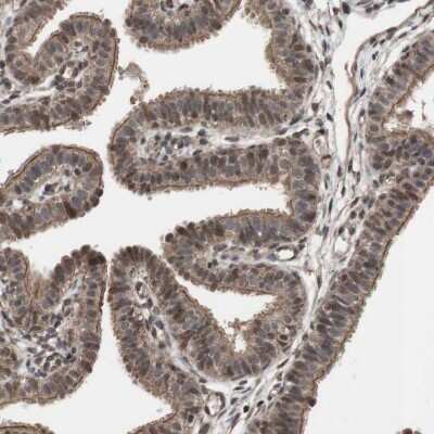 Immunohistochemistry-Paraffin: KANSL1 Antibody [NBP1-94066]