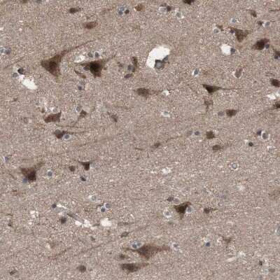 Immunohistochemistry-Paraffin: KANSL1 Antibody [NBP1-94066]
