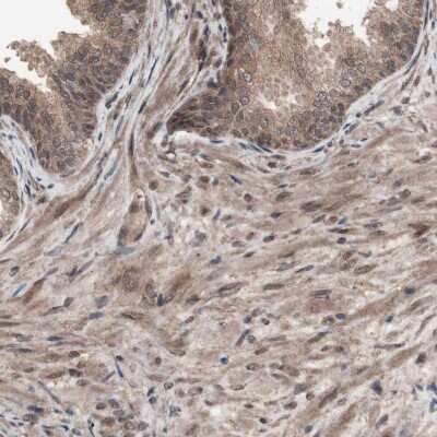 Immunohistochemistry-Paraffin: KANSL1 Antibody [NBP1-94066]