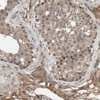 Immunohistochemistry-Paraffin: KANSL1 Antibody [NBP1-94066]