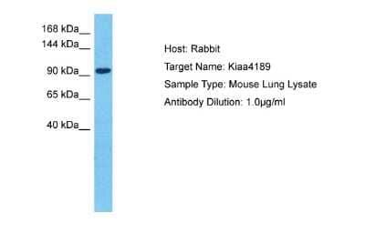 Western Blot: KANSL1L Antibody [NBP2-85130]