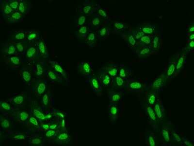 Immunocytochemistry/ Immunofluorescence: KANSL2 Antibody [NBP2-97894]