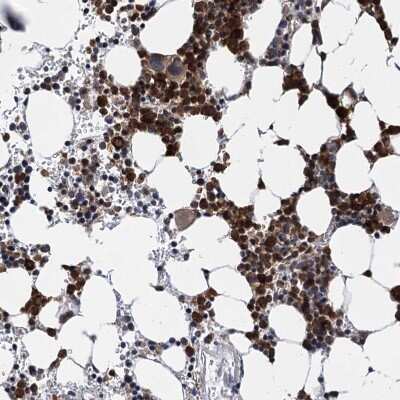 Immunohistochemistry-Paraffin: KANSL2 Antibody [NBP1-82181]