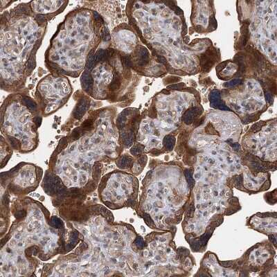 Immunohistochemistry-Paraffin: KANSL2 Antibody [NBP1-82181]