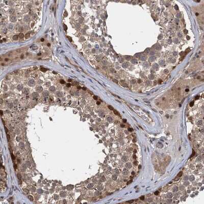 Immunohistochemistry-Paraffin: KANSL2 Antibody [NBP1-82181]