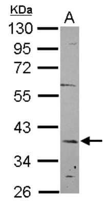 Western Blot: KANSL2 Antibody [NBP2-15633]