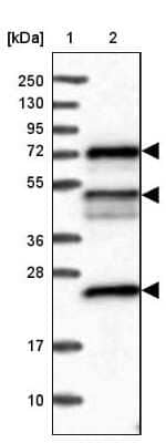 Western Blot: KANSL2 Antibody [NBP2-32637]