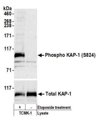 Western Blot: KAP1 [p Ser824] Antibody [NBP2-32073]