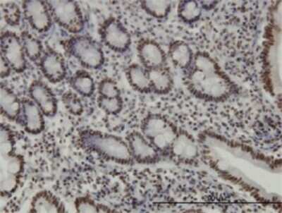 Immunohistochemistry-Paraffin: KAP1 Antibody (4E6) [H00010155-M01]