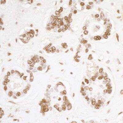 Immunohistochemistry: KAP1 Antibody (BL-248-2G6) [NBP2-76411]