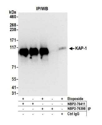 Immunoprecipitation: KAP1 Antibody (BL-248-2G6) [NBP2-76411]