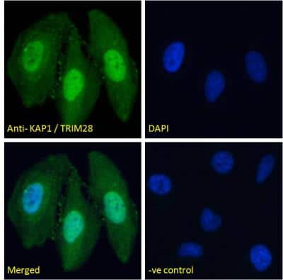 Immunocytochemistry/ Immunofluorescence: KAP1 Antibody [NB100-1161]