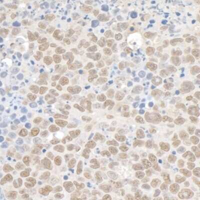 Immunohistochemistry-Paraffin: KAP1 Antibody [NB500-159]
