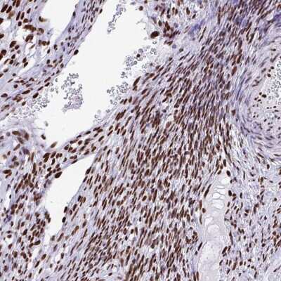 Immunohistochemistry-Paraffin: KAP1 Antibody [NBP2-39014]