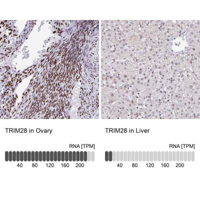 Immunohistochemistry-Paraffin: KAP1 Antibody [NBP2-39014]