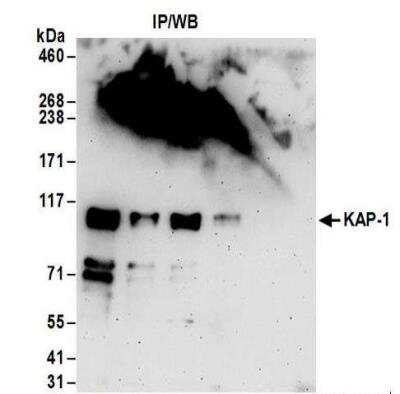 Immunoprecipitation: KAP1 Antibody [NBP2-32071]