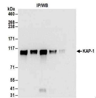Immunoprecipitation: KAP1 Antibody [NBP2-32072]