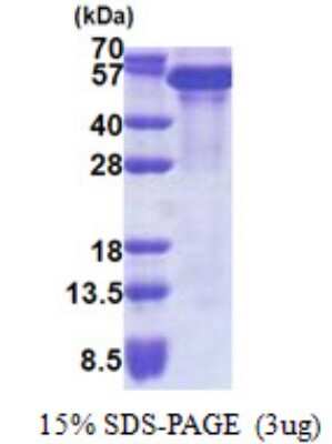 SDS-PAGE: Recombinant Human KAP1 His Protein [NBP2-22889]